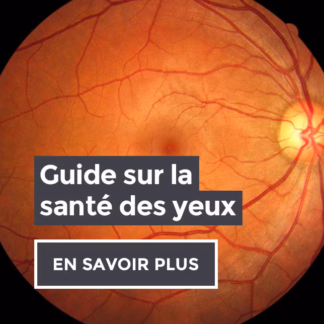 Eye Health Guides