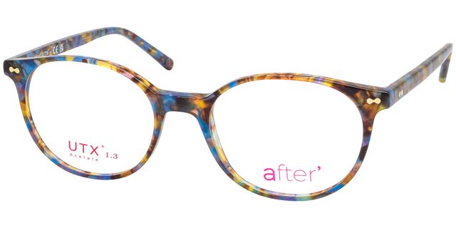 after - AF151