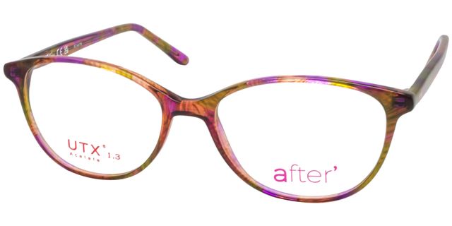 after - AF149